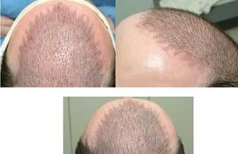 Pedro Mendes de Oliveira - Foto 1